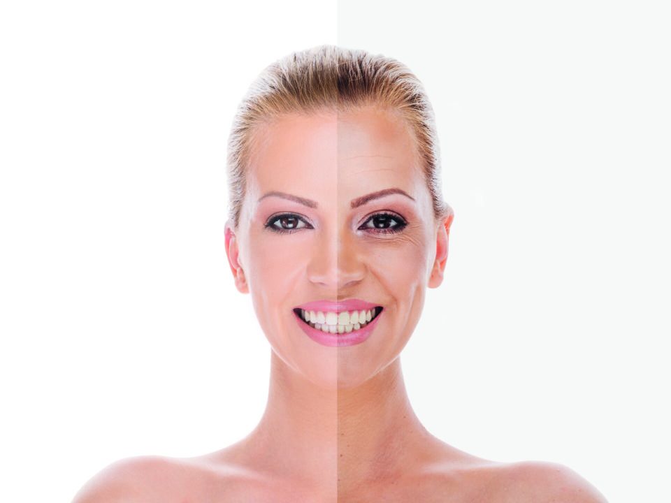 non-surgical facelift
